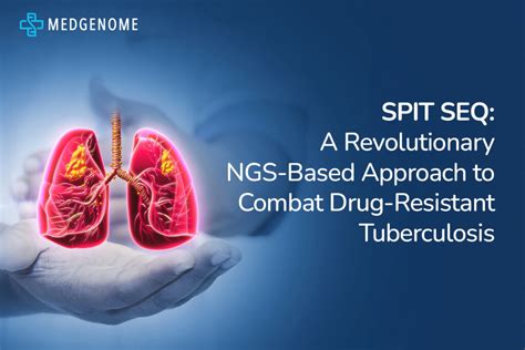 SPIT SEQ: A Game Changer in Drug-Resistant TB Detection