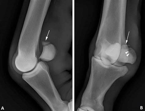 Image:Sesamoid bone apical fracture radiographs, horse-MSD Veterinary ...
