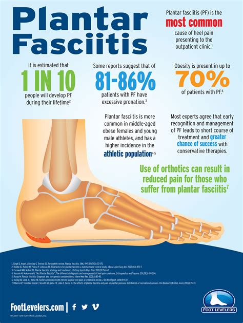 Plantar Fasciitis