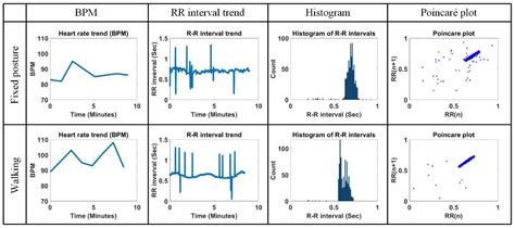 Efficient Real-Time R and QRS Detection Method Using a Pair of ...