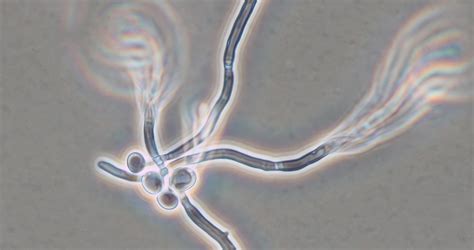 白色念珠菌：存在于我们之中的危险真菌-查士利华微生物应用技术（上海）有限公司