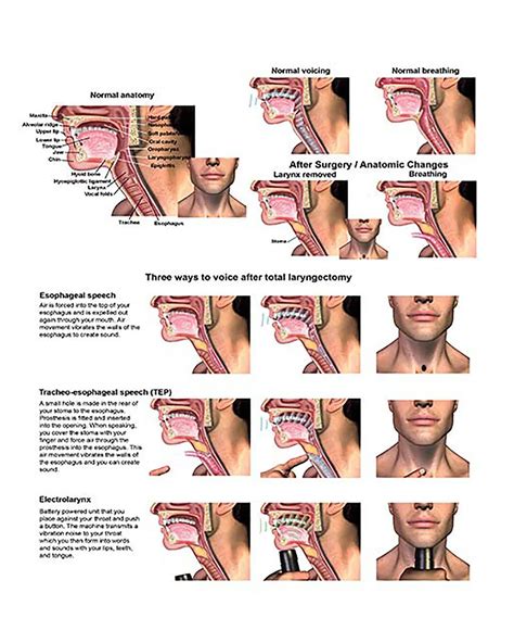 Ynb Electronic Larynx Anatomy Poster Human Larynx Scientific Wall Charts | Desertcart GB