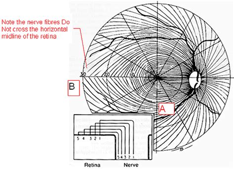 Image result for Visual Field Screen