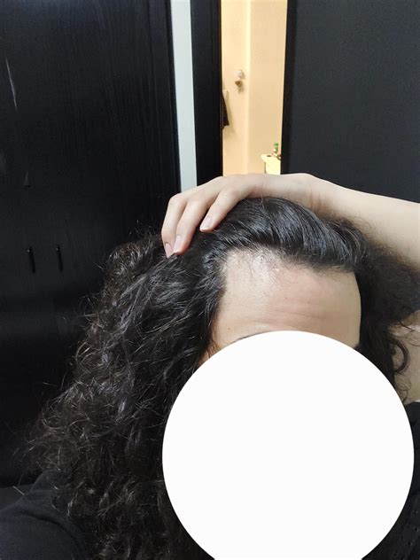 Is this just an m-shaped hairline or am I balding? : r/malehairadvice