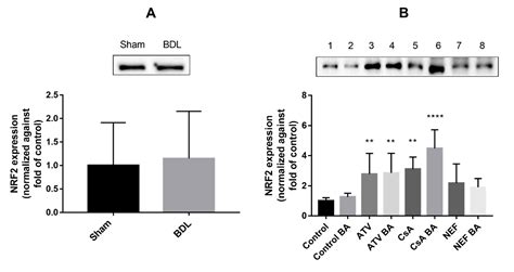Cholestasis Differentially Affects Liver Connexins