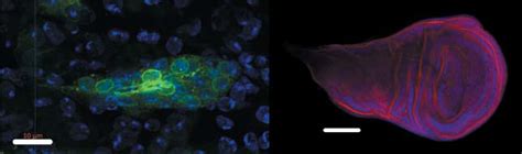 Centre for Human Genetics