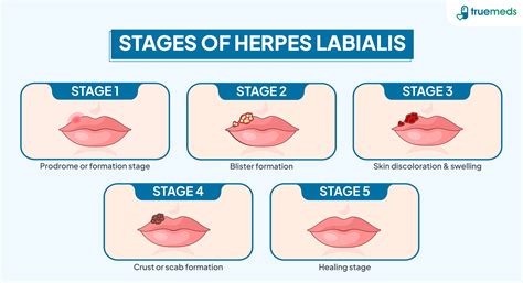 Blood Blister Healing Stages