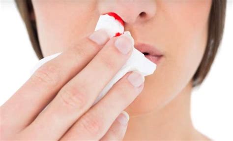 Nose bleeding: इन 6 उपाय से बंद होगा बच्चों की नाक से खून