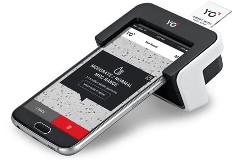 Sperm fertility test made simpler with smartphones - IBTimes India