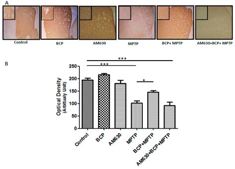 Correction: Viveros-Paredes et al. Neuroprotective Effects of β ...