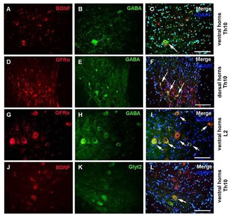 Impact of Endurance Training on Regeneration of Axons, Glial Cells, and ...