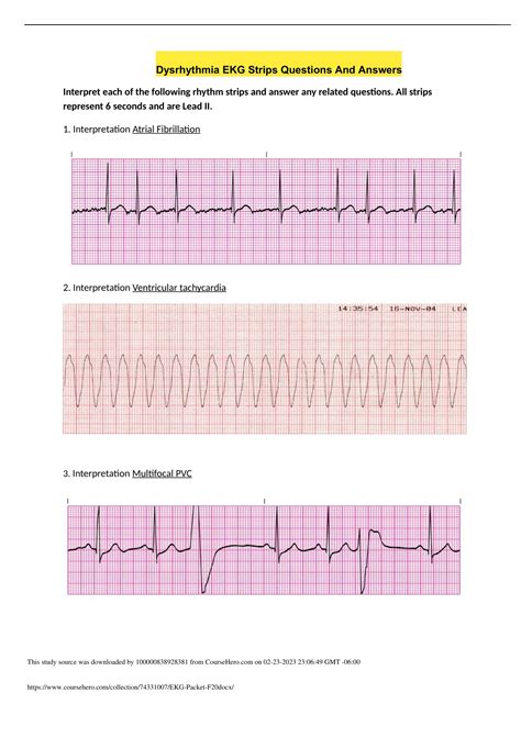 Dysrhythmia EKG Strips Questions And Answer - Dysrhythmia EKG - Stuvia US