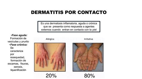 DERMATITIS POR CONTACTO.pptx