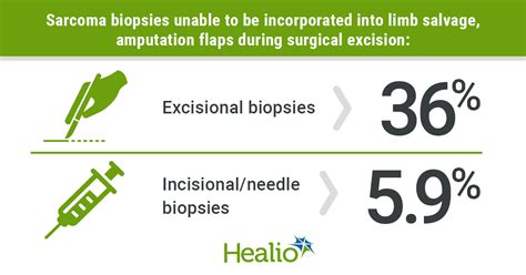 Image result for Soft Tissue Sarcoma Hand