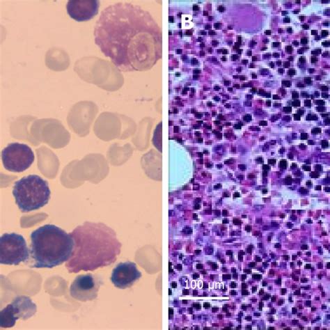 Bone Marrow Testing 的图像结果