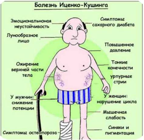 Лечение иценко кушинга: Синдром Иценко-Кушинга — причины появления ...