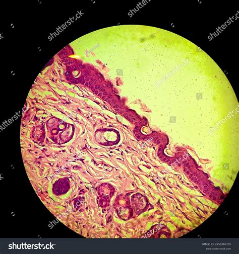 Skin Cell Under Microscope