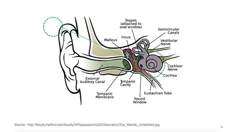 D'source Case Study - Slide Show | Musical Habilition for Hearing ...
