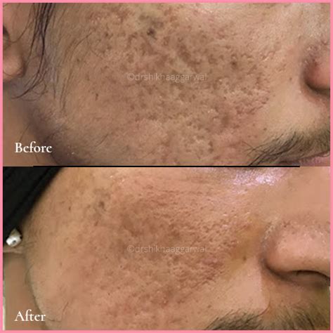 Real Results - Dr. Shikha Aggarwal