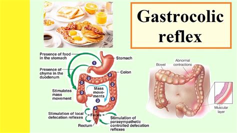 Why am I getting “The caller does not have permission” even after enabling the Sheets API? - Stack O PNG