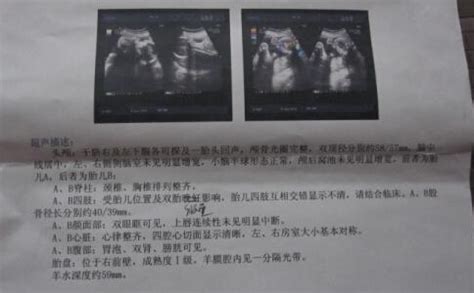 胎儿发育标准对照表图（附胎儿体重计算公式）_腾讯新闻