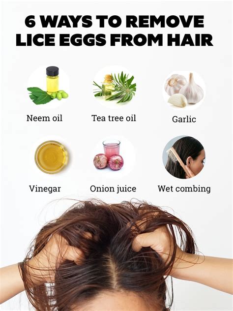 Pin on home remedy lice