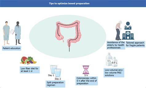 Image result for Colonoscopy Preparation