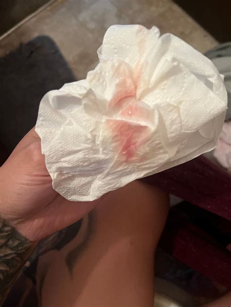 Bleeding During Ovulation