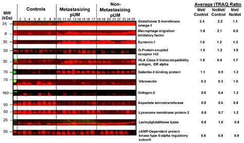 Proteomics of Primary Uveal Melanoma: Insights into Metastasis and ...