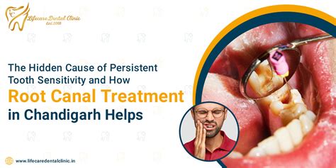 Best Dentist in Chandigarh for 27 years | Life Care Dental Clinic