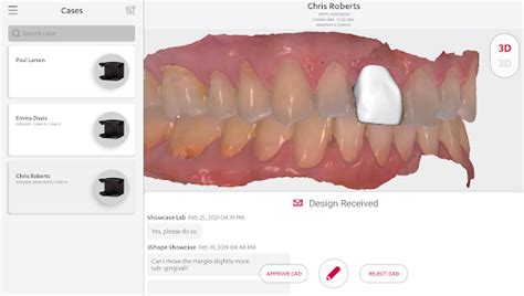 Image result for 3Shape Communicate Tutorial