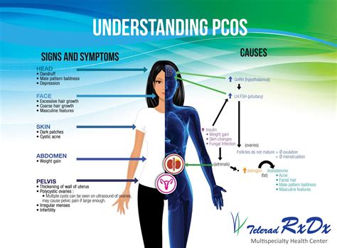 Think you have PCOS? - Understand PCOS: Risks, Symptoms & Complications ...