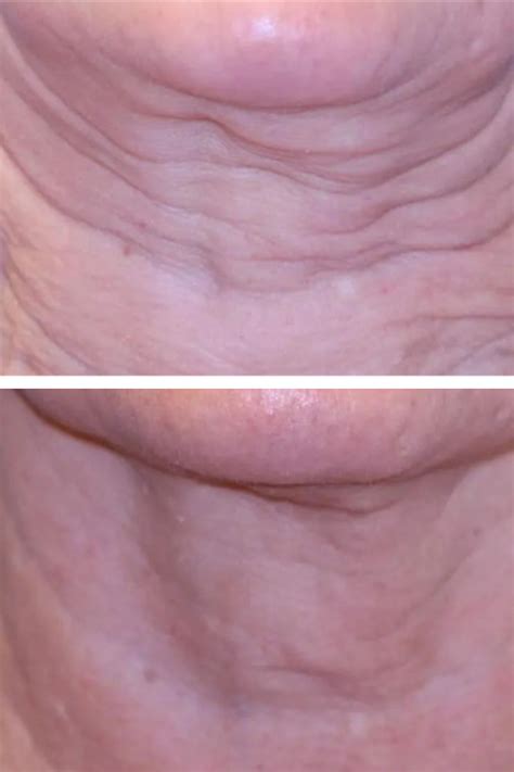 Image result for Sofwave Log