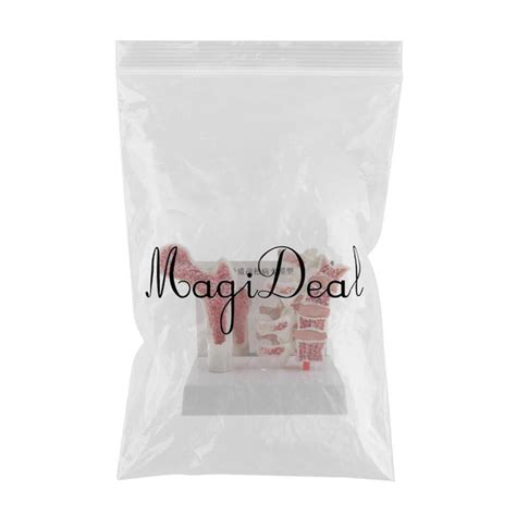 ⚡️Buy Maxbell 1:1 Human Lumbar Vertebra Thighbone Osteoporosis ...