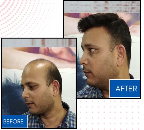 Best Hair Weaving Center in Agartala Tripura