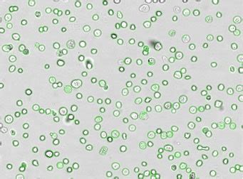 Surface Marker & Intracellular Protein Detection Methods | Revvity