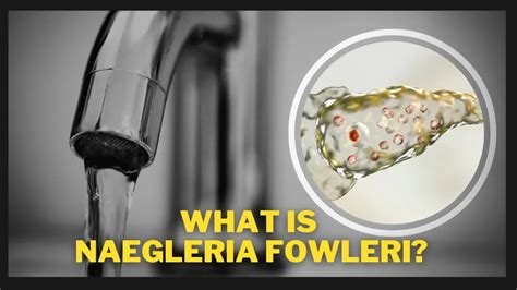 What Is Naegleria Fowleri? The Deadly Brain-Eating Amoeba Infection ...