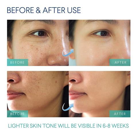 How To Get Rid Of Bumps On Skin After Shaving at Helene Winkleman blog