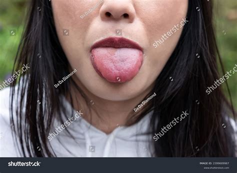 Woman Shows Large Swollen Tongue Allergic Stock Photo 2399689967 | Shutterstock