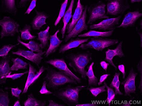 DRP1 (C-terminal) antibody (CL647-12957) | Proteintech