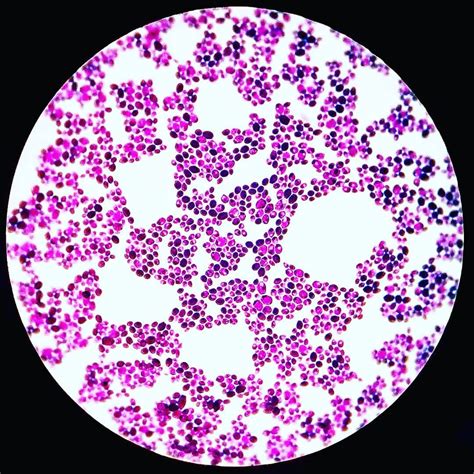 Candida albicans Gram stain. | Candida albicans, Candida, Microbiology