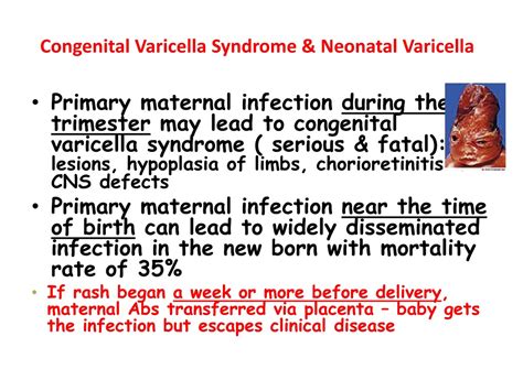 PPT - Herpes viruses PowerPoint Presentation, free download - ID:392168