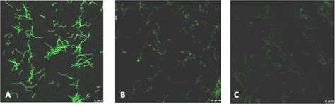 A Seventeen-Year Epidemiological Surveillance Study of Borrelia ...