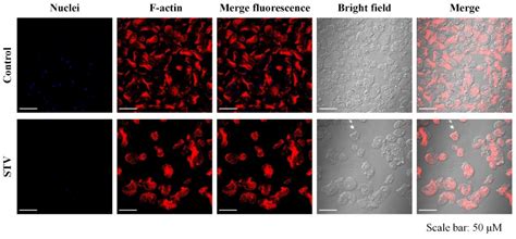 Effect of Stevioside (Stevia rebaudiana) on Entamoeba histolytica ...