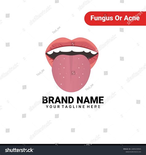 Fungus Acne On Tongue Vector Illustration Stock Vector (Royalty Free) 2265219501 | Shutterstock
