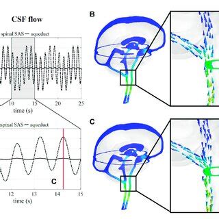 CSF Flow Pathway 的图像结果