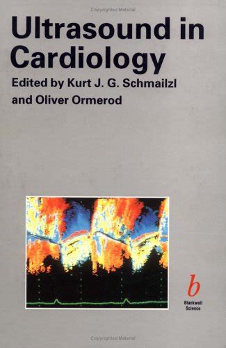 Ultrasound in Cardiology – Retail Maharaj