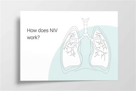A comprehensive guide to noninvasive ventilation (NIV) | Hamilton Medical