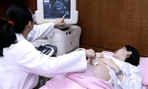 孕期的一次大考——胎儿结构超声检查，你做对了吗？_宝宝_医生_评估风险