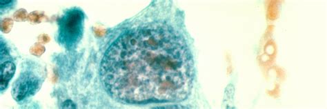 Ubio Biotechnology Systems Pvt Ltd